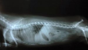 워블러 증후군의 원인, 증상 및 치료