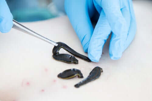 의료용 피부 재생