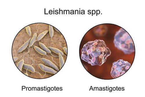 리슈마니아증 기생충